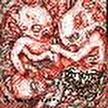 Aborted Fetus