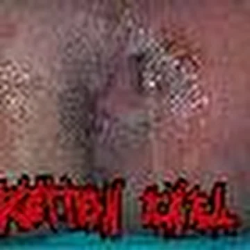 Rotten Anal