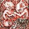 Aborted Fetus