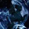 extremum