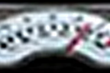user bar