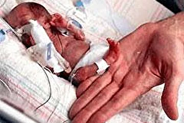 Рождение человека - велике чудо! А это самый маленький человечек на земле.