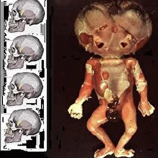 imbiciL MuTanT