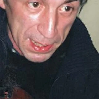 1zema